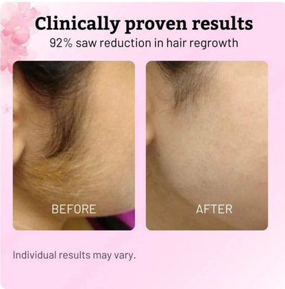 Cyperus Rotundus Oil