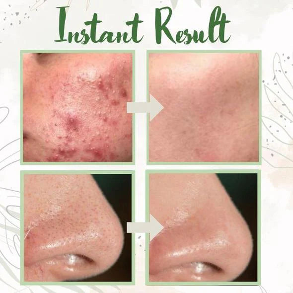 Green Tea Instant Exfoliating Stick