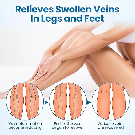 Timilk VeinGuard Herbal Spray