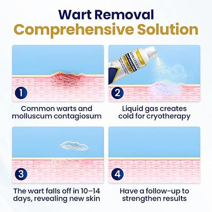 Chill Erase Bump Renewal Spray