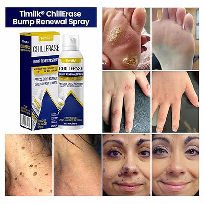 Chill Erase Bump Renewal Spray