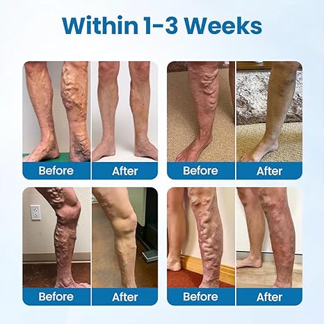 Timilk VeinGuard Herbal Spray