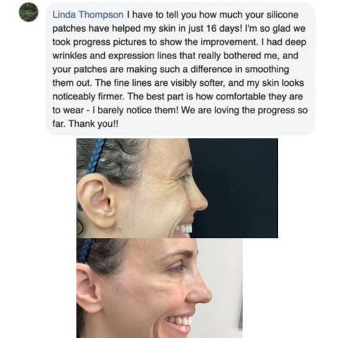 HoneyPeel™ - 
Silicone Scar Sheets