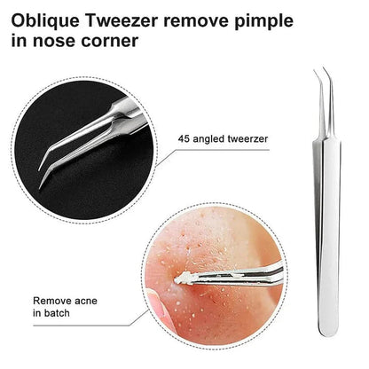3 Piece Tweezer Set