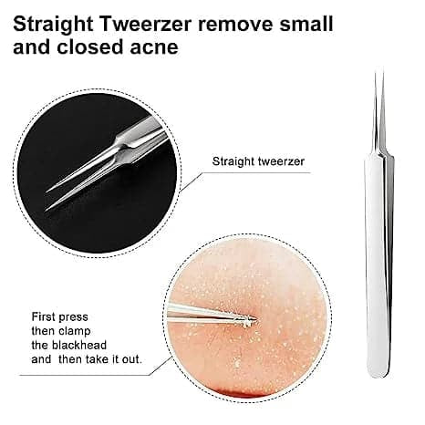 3 Piece Tweezer Set