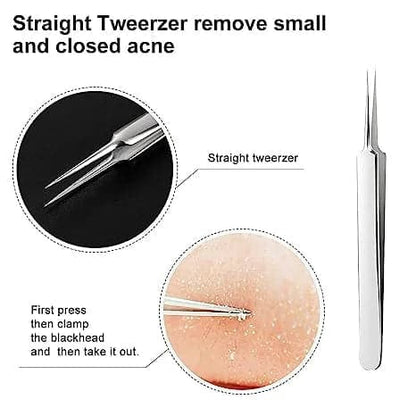 3 Piece Tweezer Set
