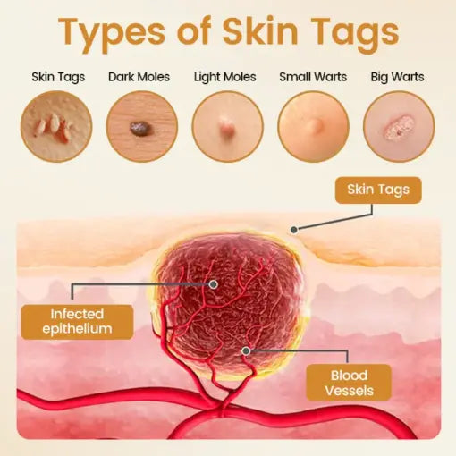 BeeVenom Wart Renewal Spray