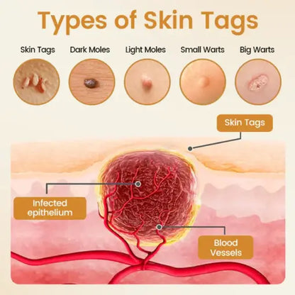 BeeVenom Wart Renewal Spray