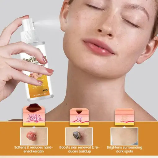 BeeVenom Wart Renewal Spray