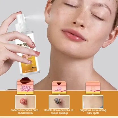 BeeVenom Wart Renewal Spray